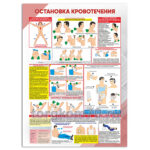 Стенд "Остановка кровотечения"